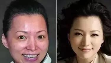 做美容與不做美容的差距